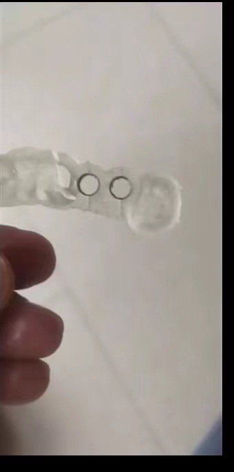 Resin Dental 3D Printer Planti - 3D Printing Uv Resin recension och pris